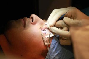 Soldier receives Lasik eye surgery
